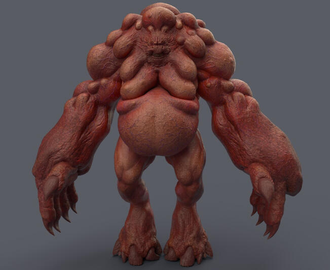 Tumor- 3D model